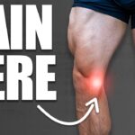 MCL Injury Rehab & Exercises (Medial Collateral Ligament Sprain)