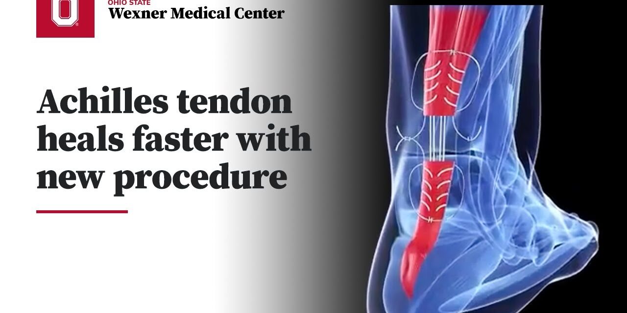 Achilles tendon heals faster with new surgical procedure | Ohio State Medical Center