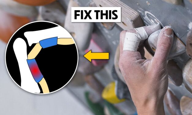 How to Fix Climbing's Most Common Injury